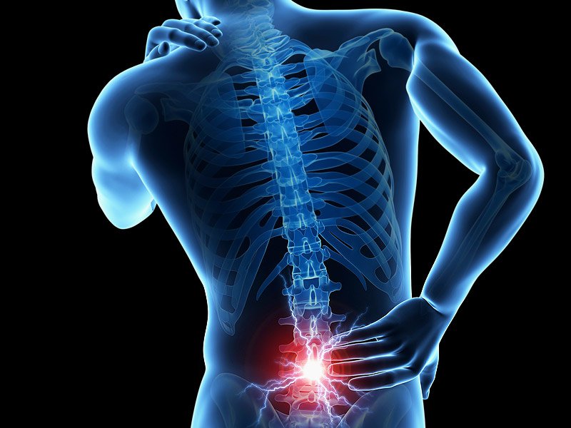 Lower Back Pain Dr Michael A Castillo MD