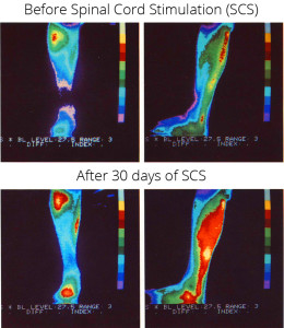 thermography 