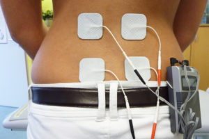 electrotherapy - TENS Therapy
