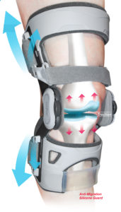 image showing knee brace helping to align knee and relieve pressure on joint